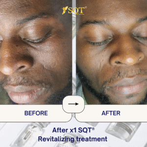 Before and After (1)