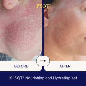 Before and After (10)