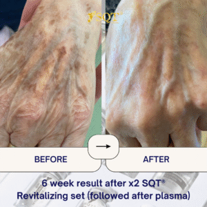 Before and After (11)