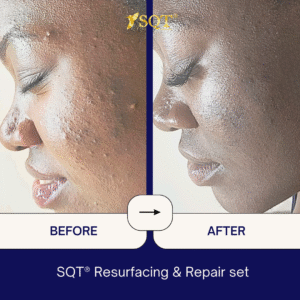 Before and After (12)