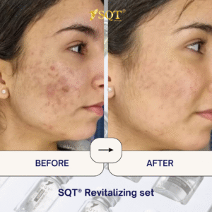 Before and After (14)