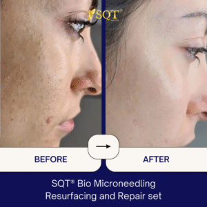 Before and After (15)