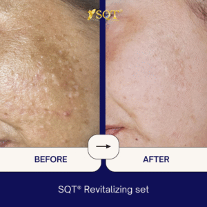 Before and After (2)