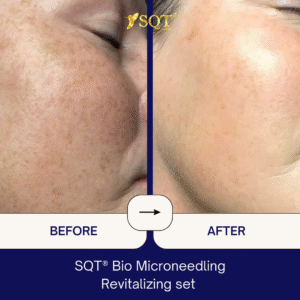 Before and After (3)