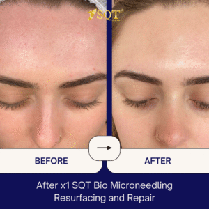 Before and After (4)