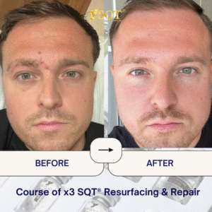 Before and After (5)