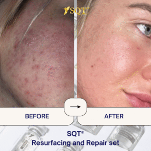 Before and After (6)