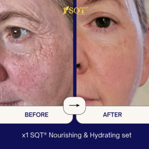 Before and After (7)