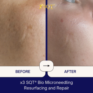 Before and After (8)