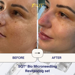 Before and After (9)